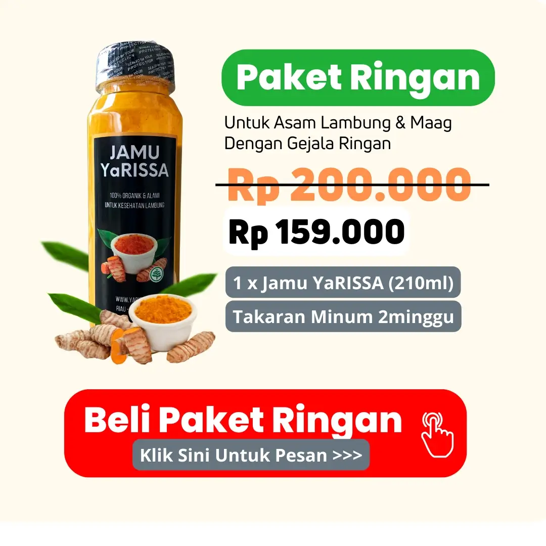 Harga Yarissa Paket Ringan